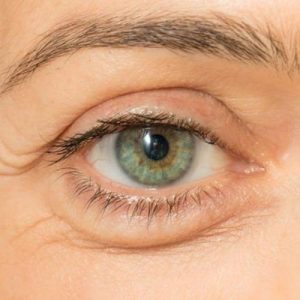 Use Castor oil for Eyes and Discover 6 Benefits You Didn't Know About