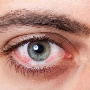 Use Castor oil for Eyes and Discover 6 Benefits You Didn't Know About